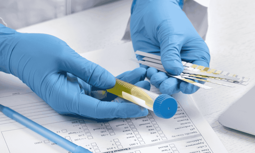 Análisis de laboratorio y reproducción